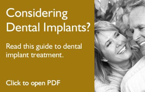 Dental Implants | Alchemy Dental Practice